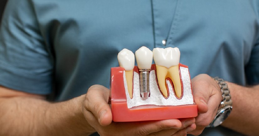 Cosmetic Dentistry Bangalore